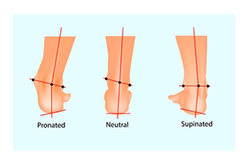 Sports Related Foot and Ankle Injuries